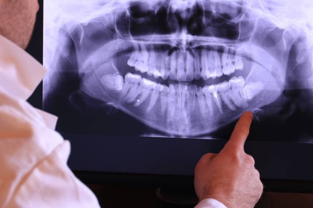 Best Knocked-Out Tooth (Avulsed Tooth) Treatment in Governors Clu, NC